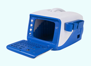 ultrasound scanner injection mould -